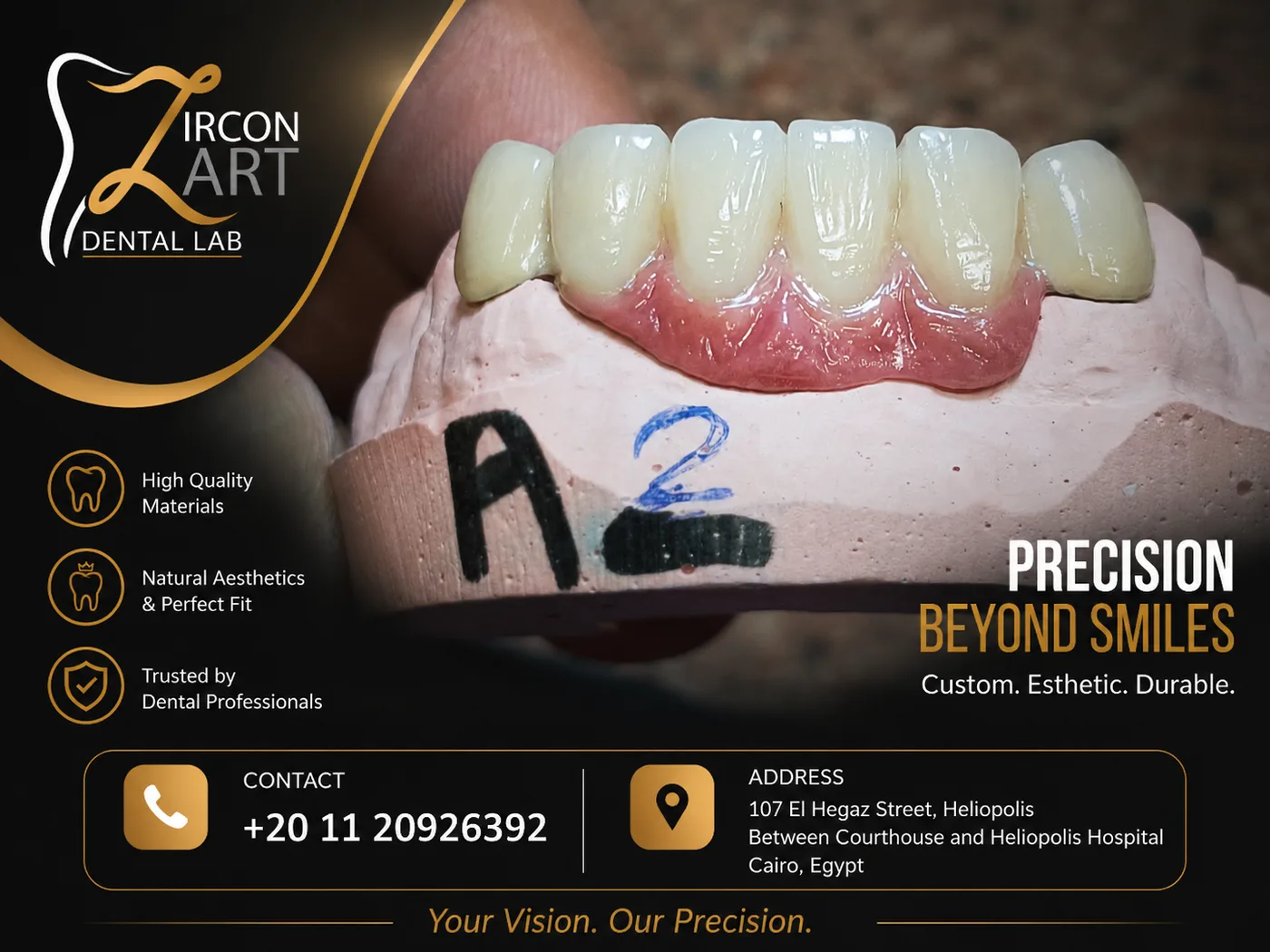 Zirconia bridge on an articulated dental model showing precision craftsmanship by Zircon Art Dental Laboratory